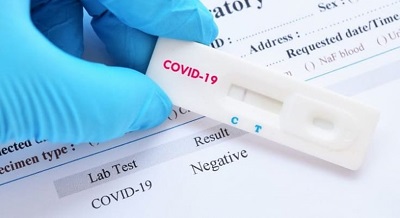 Média móvel de novos casos de Covid-19 cai 30% em relação há duas semanas