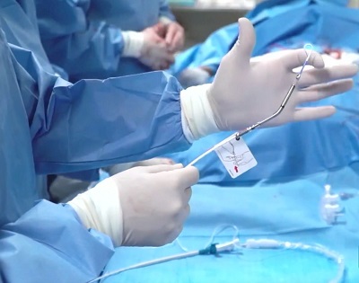 Hospital Aliança realiza procedimento complexo que mantém coração com circulação adequada 