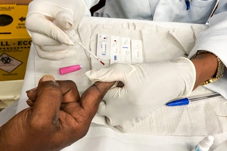 Feira de Santana registra mais de 300 casos de HIVAids neste ano